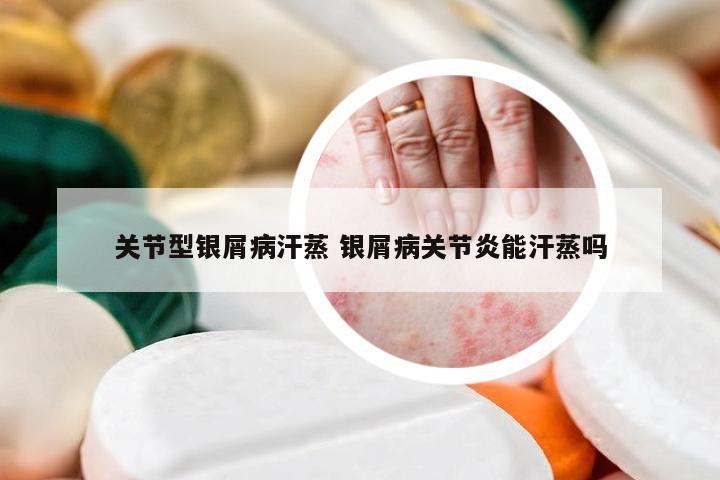 关节型银屑病汗蒸 银屑病关节炎能汗蒸吗