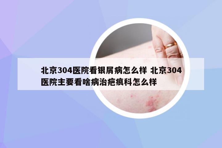 北京304医院看银屑病怎么样 北京304医院主要看啥病治疤痕科怎么样