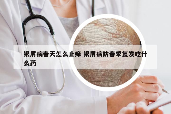 银屑病春天怎么止痒 银屑病防春季复发吃什么药