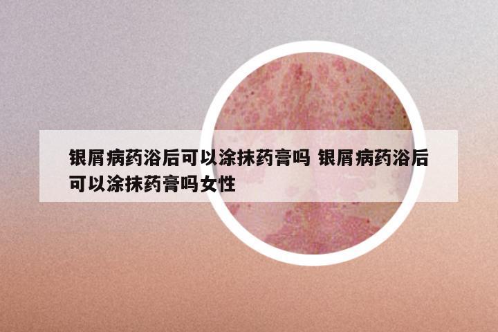 银屑病药浴后可以涂抹药膏吗 银屑病药浴后可以涂抹药膏吗女性