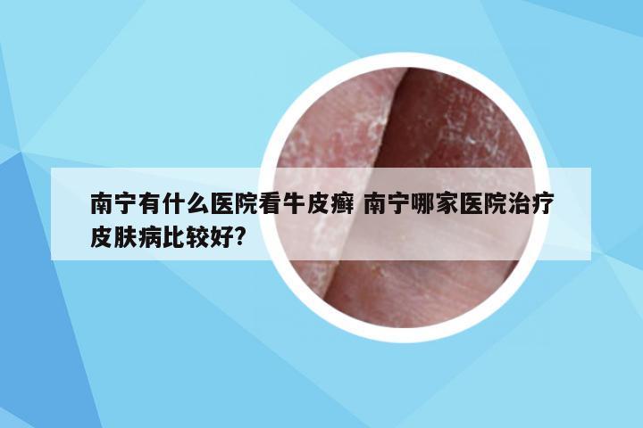 南宁有什么医院看牛皮癣 南宁哪家医院治疗皮肤病比较好?