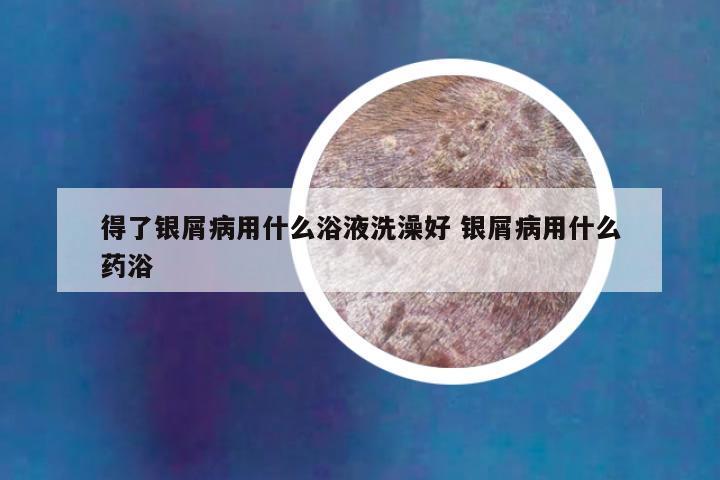 得了银屑病用什么浴液洗澡好 银屑病用什么药浴