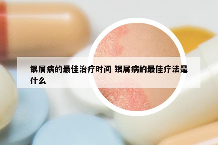 银屑病的最佳治疗时间 银屑病的最佳疗法是什么