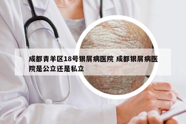 成都青羊区18号银屑病医院 成都银屑病医院是公立还是私立