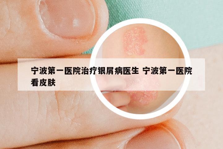 宁波第一医院治疗银屑病医生 宁波第一医院看皮肤