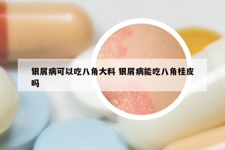 银屑病可以吃八角大料 银屑病能吃八角桂皮吗