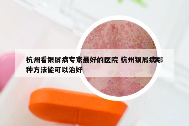 杭州看银屑病专家最好的医院 杭州银屑病哪种方法能可以治好