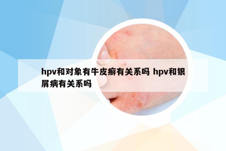 hpv和对象有牛皮癣有关系吗 hpv和银屑病有关系吗