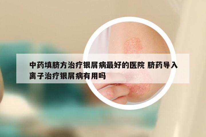 中药填脐方治疗银屑病最好的医院 脐药导入离子治疗银屑病有用吗