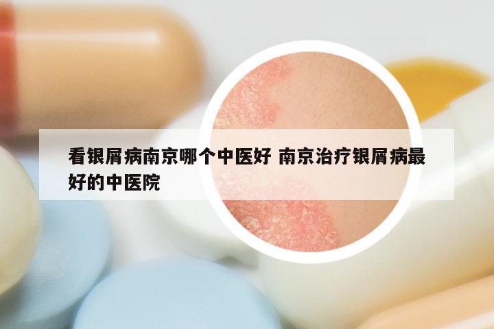 看银屑病南京哪个中医好 南京治疗银屑病最好的中医院