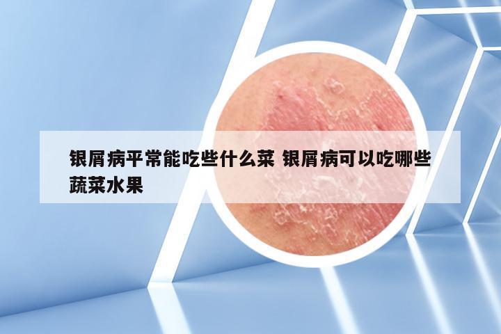 银屑病平常能吃些什么菜 银屑病可以吃哪些蔬菜水果