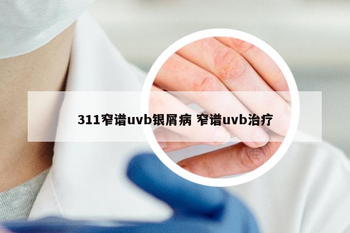 311窄谱uvb银屑病 窄谱uvb治疗