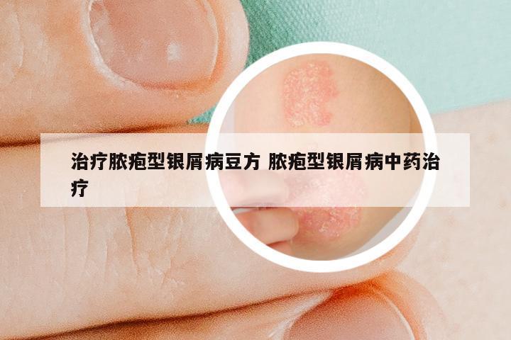 治疗脓疱型银屑病豆方 脓疱型银屑病中药治疗