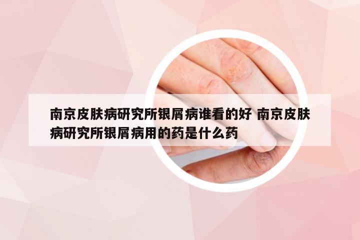 南京皮肤病研究所银屑病谁看的好 南京皮肤病研究所银屑病用的药是什么药