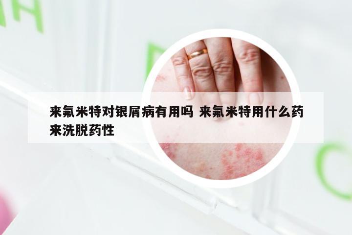 来氟米特对银屑病有用吗 来氟米特用什么药来洗脱药性